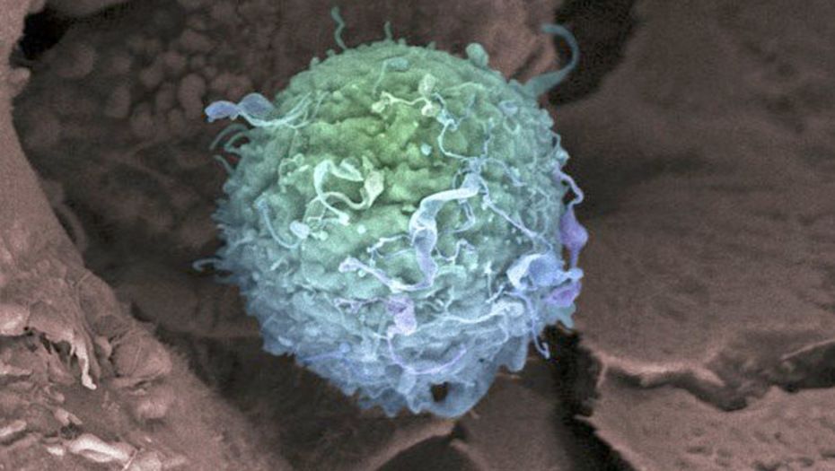Una nueva “biopsia líquida” permitiría detectar el cáncer antes de que se desarrolle