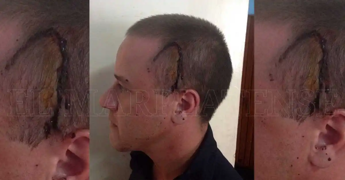 Un mantero agredió a un policía en plena Peatonal