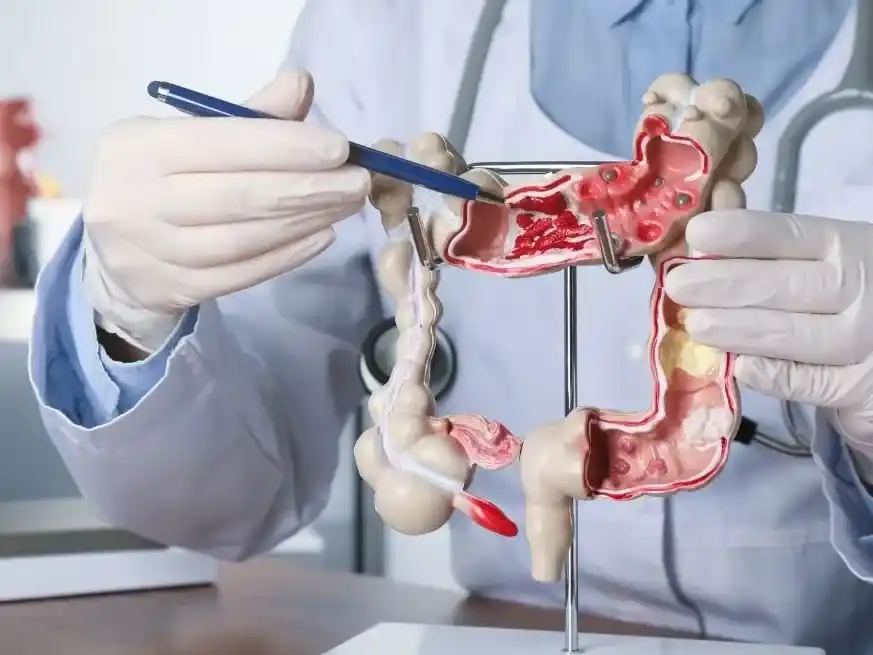 31 de Marzo: Día Mundial contra el Cáncer de Colon. Gentileza