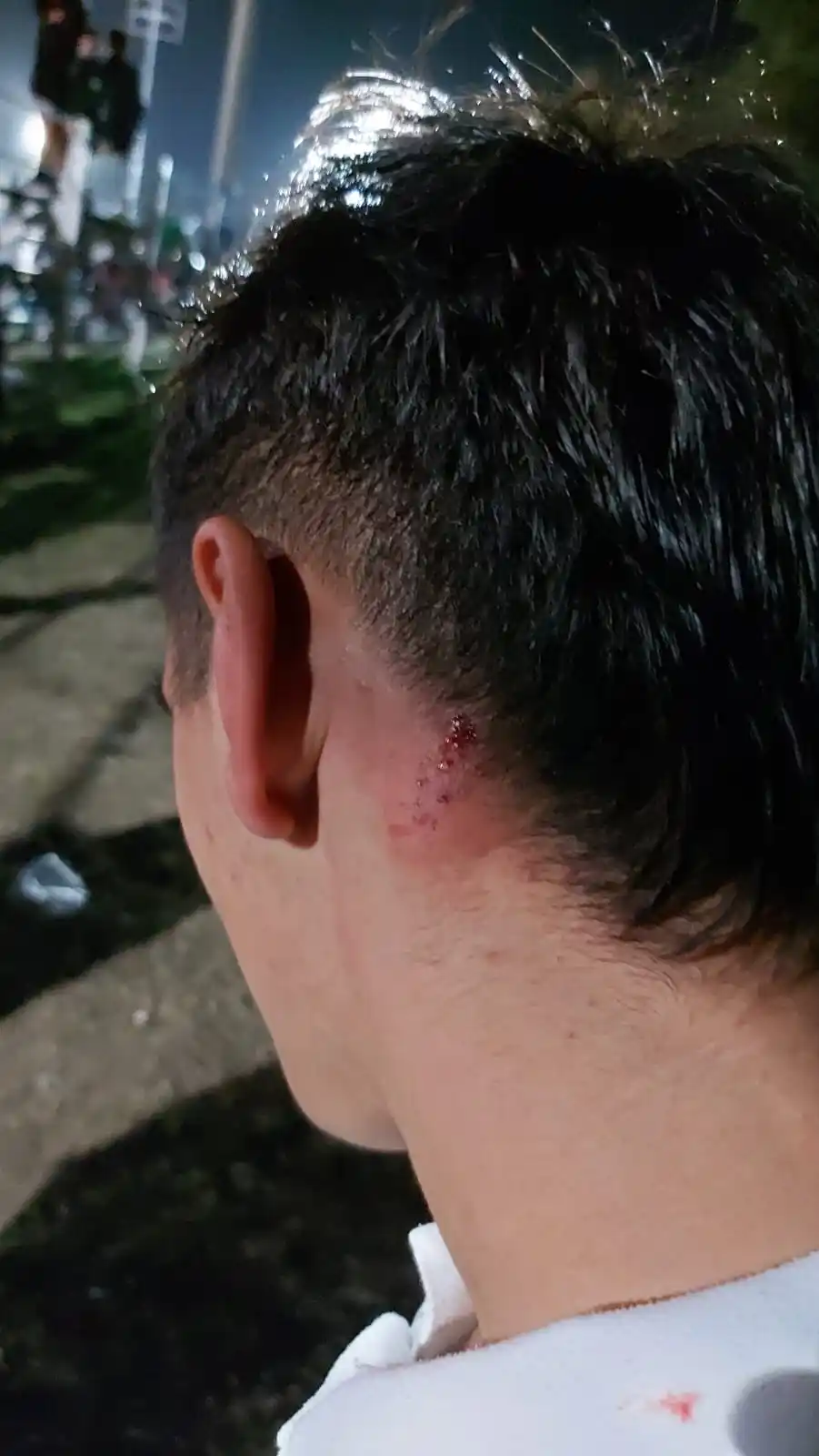 Agustín Godoy y la herida en la nuca que le provoco el proyectil.