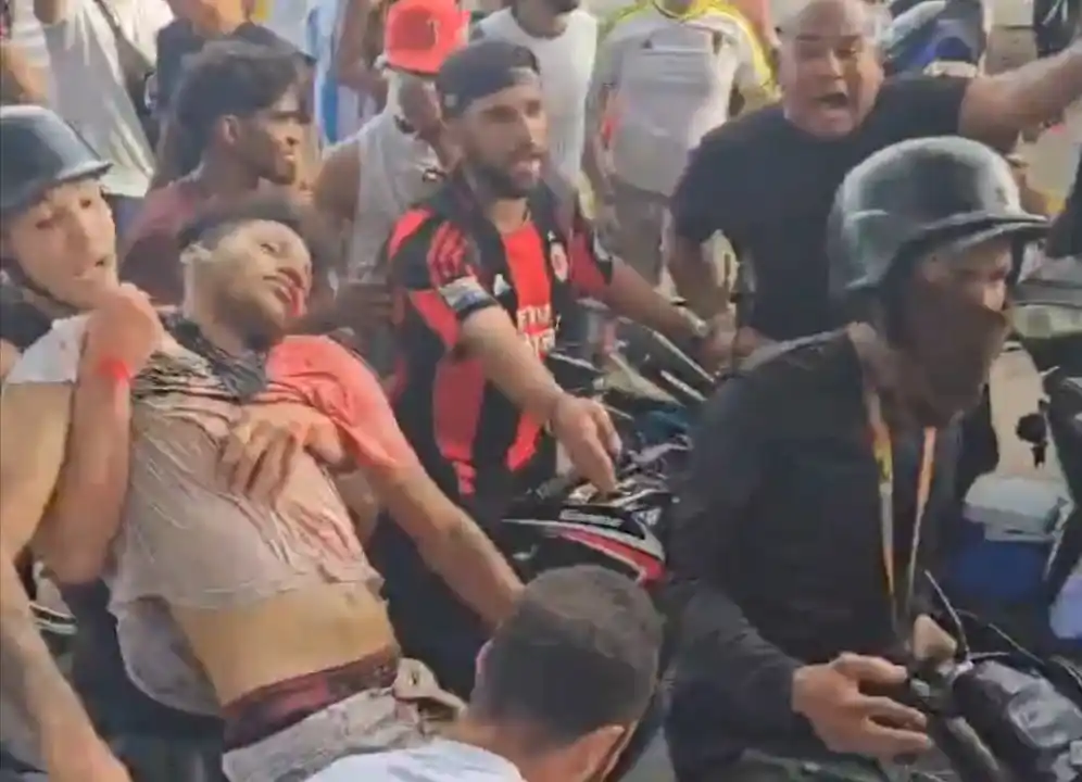 El joven recibió una herida de bala mientras participaba de una manifestación en Maracay.