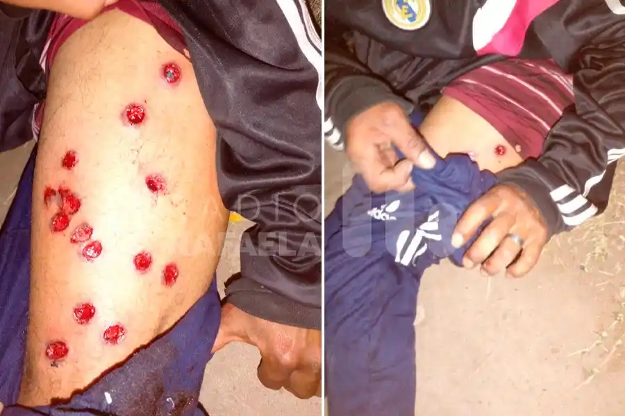 Policías y vecinos acabaron con diferentes heridas luego de los incidentes en el barrio 2 de Abril