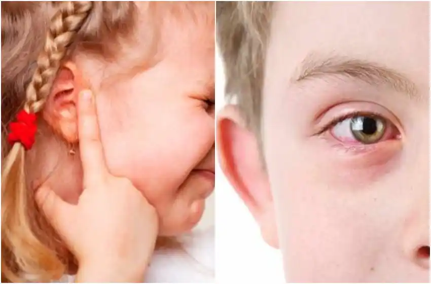Infecciones de verano: otitis y conjuntivitis