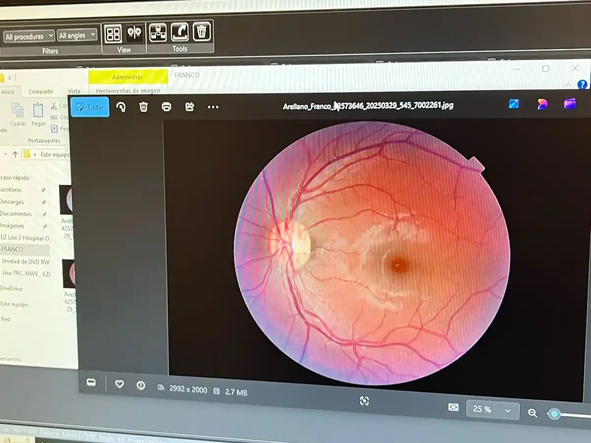 retinar 01-08-25 - 1