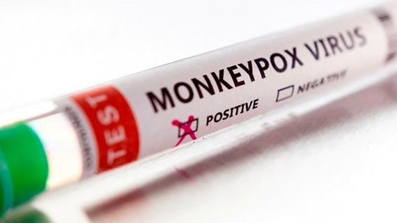 Europa registra casi 18 mil casos de viruela del mono desde abril