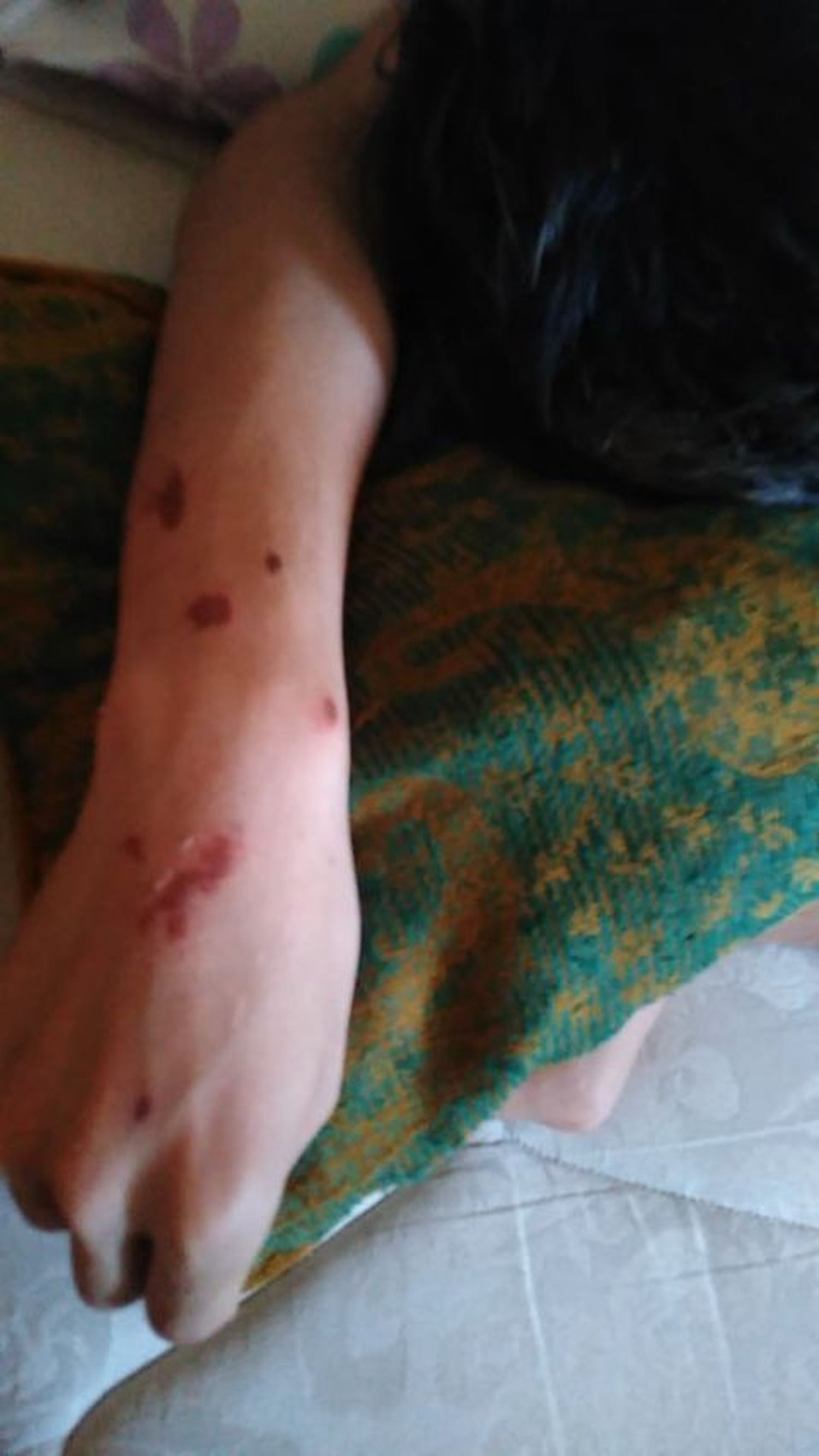 Lo golpearon para robar un celular