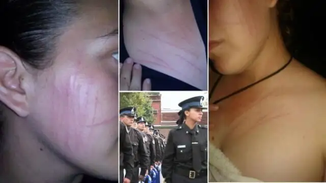 Realizaron más denuncias por ataques de fantasmas 