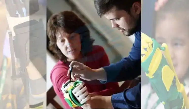 Una esperancina recibió una prótesis con movimiento para su mano