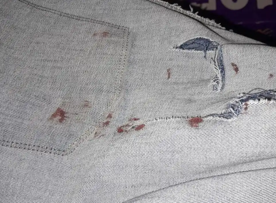 Perro que muerde por Novillo, entre Salta y Pellegrini 