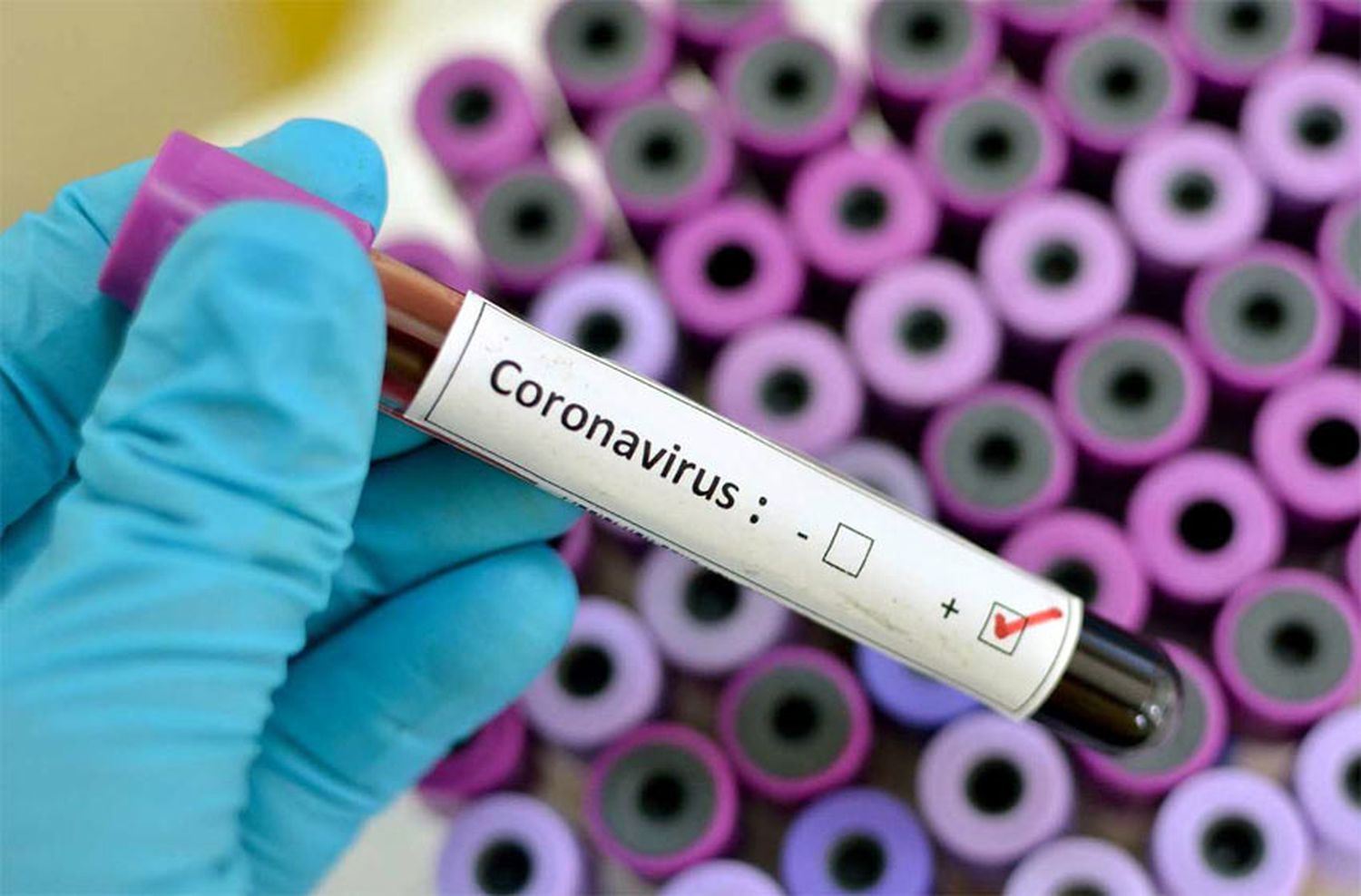 El coronavirus ya provocó más de medio millón de muertes en el mundo