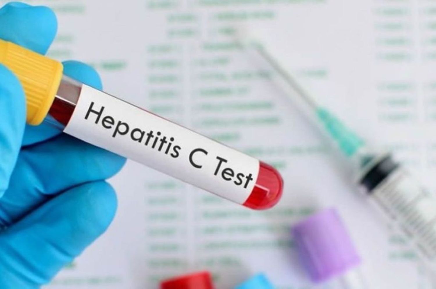 Realizan test de detección gratuita de Hepatitis C en hospitales de todo el país