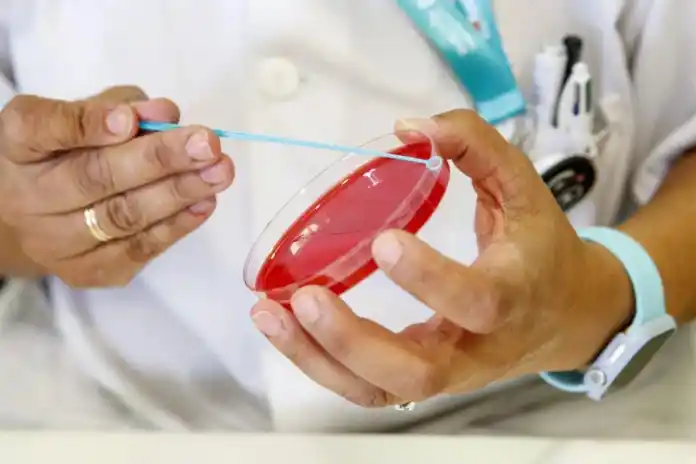 Advierten por un crecimiento de la sífilis con cifras récord en 2023 y tendencias que siguen en alza.