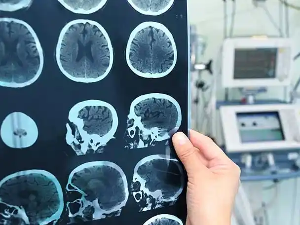 Gualeguaychú cuenta con un protocolo eficaz para atender un ACV a tiempo