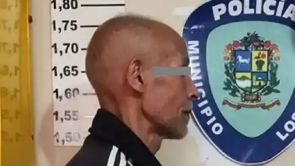 A YARE III: imputan al coronel que dio brutal golpiza a su pareja