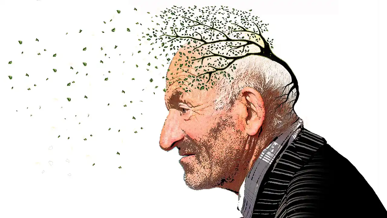 Avance contra el Parkinson: un implante cerebral guiado por IA redujo 50% los síntomas en un estudio
