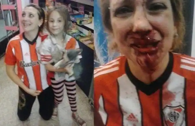 Un hombre desfiguró a una mujer porque festejaba el triunfo de River