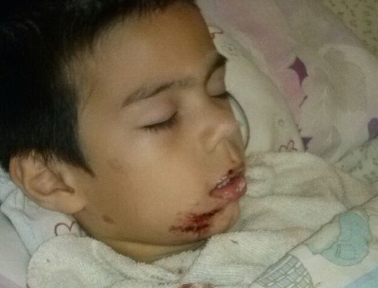 Otro niño fue atacado por un perro callejero en la plaza San Martín