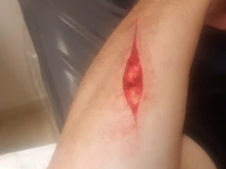 recolector cortado 10-06-25