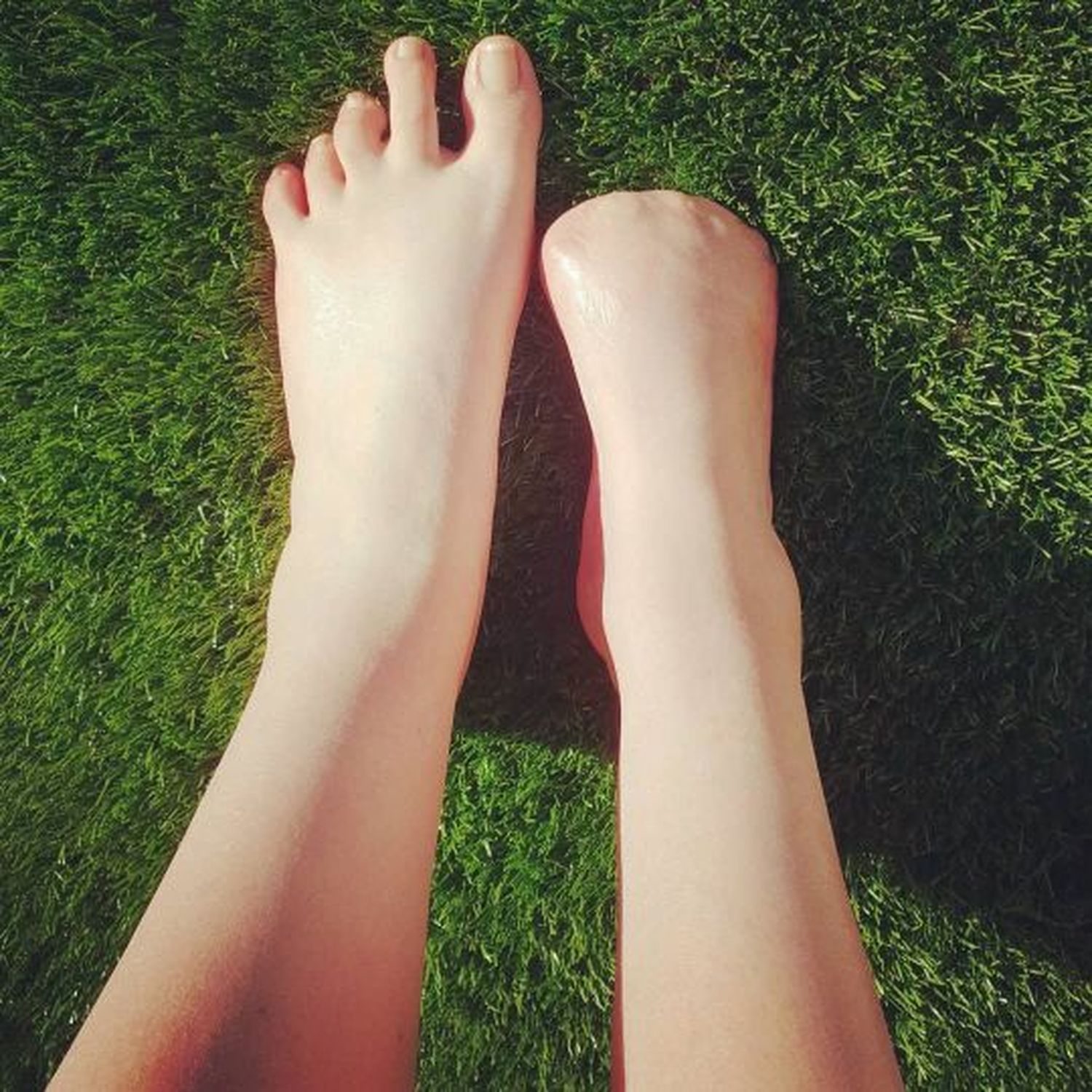 Se hizo una pedicura con peces y terminó con cinco dedos del pie amputados
