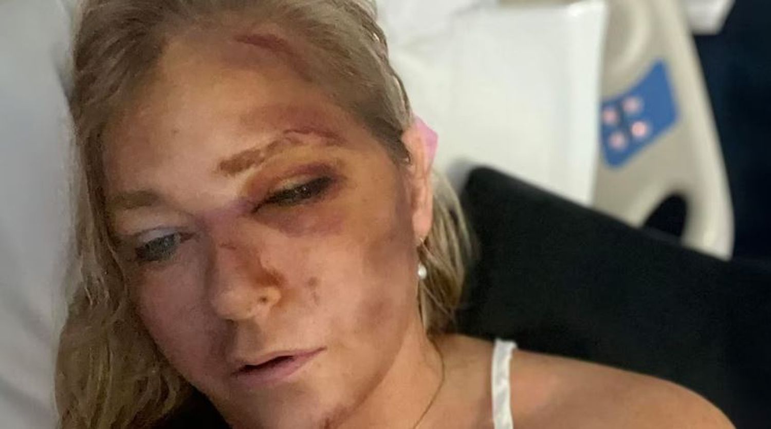La mujer que denunció a Jeffrey Epstein y al príncipe Andrés por abuso sexual reveló que le quedan “días de vida”