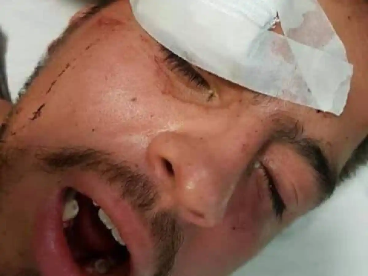 Estudiante de San Francisco habría sido agredido por policías en Jesús María