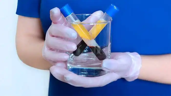 En Santa Fe harán las primeras donaciones de plasma de recuperados de COVID-19