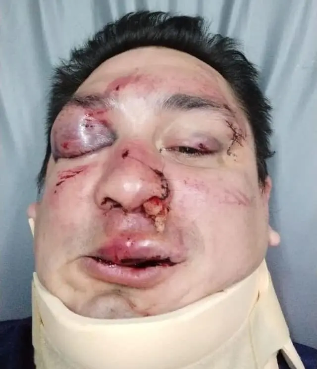 Barras de Racing agredieron brutalmente a un periodista