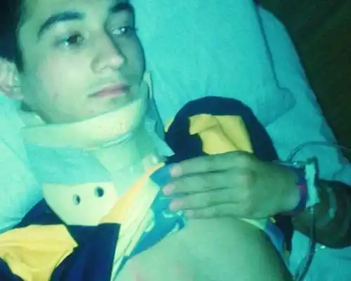 Así quedó un jugador de Juventud Urdinarrain tras un "planchazo" 