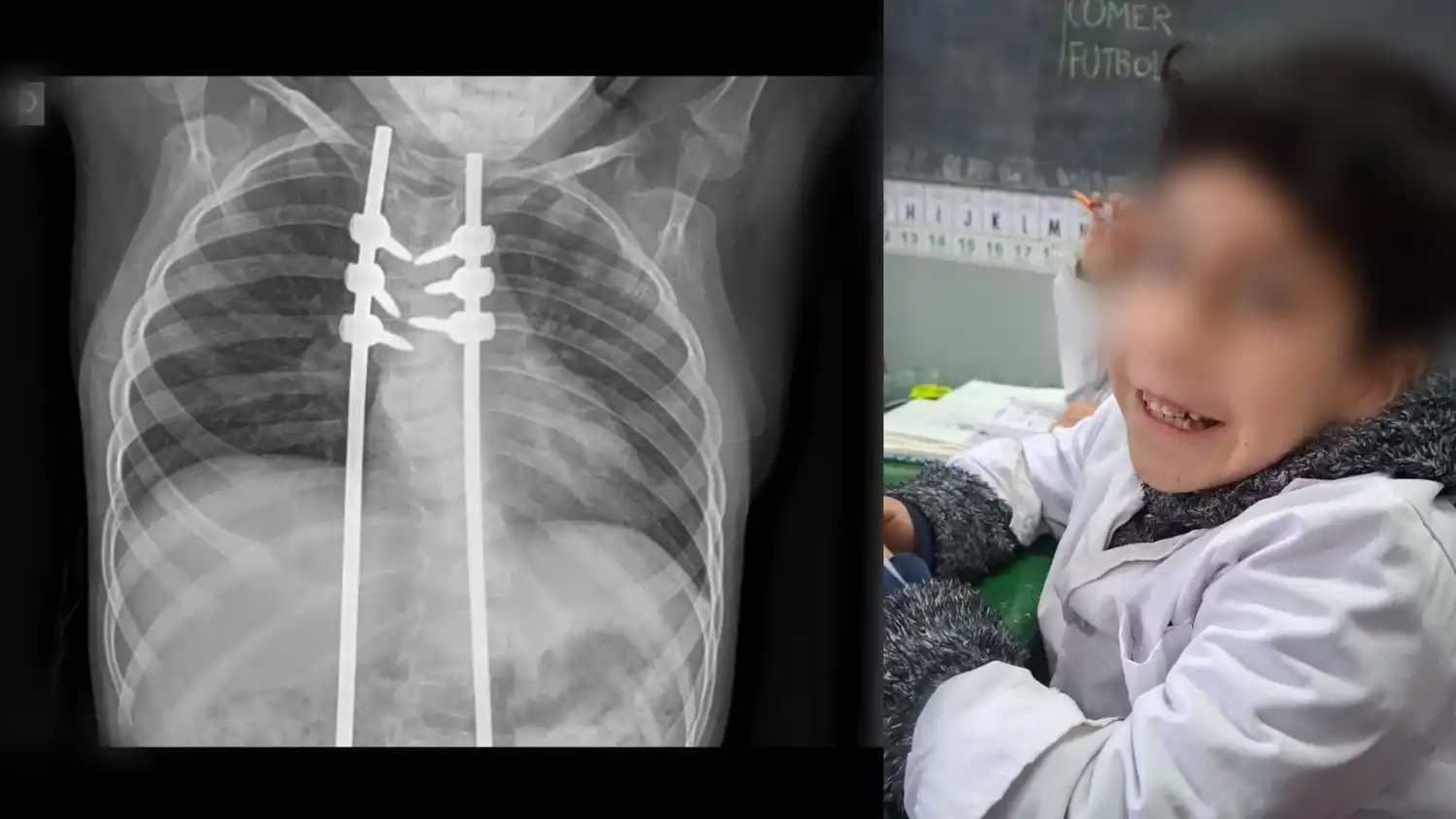 Radiografía de la situación de Julián