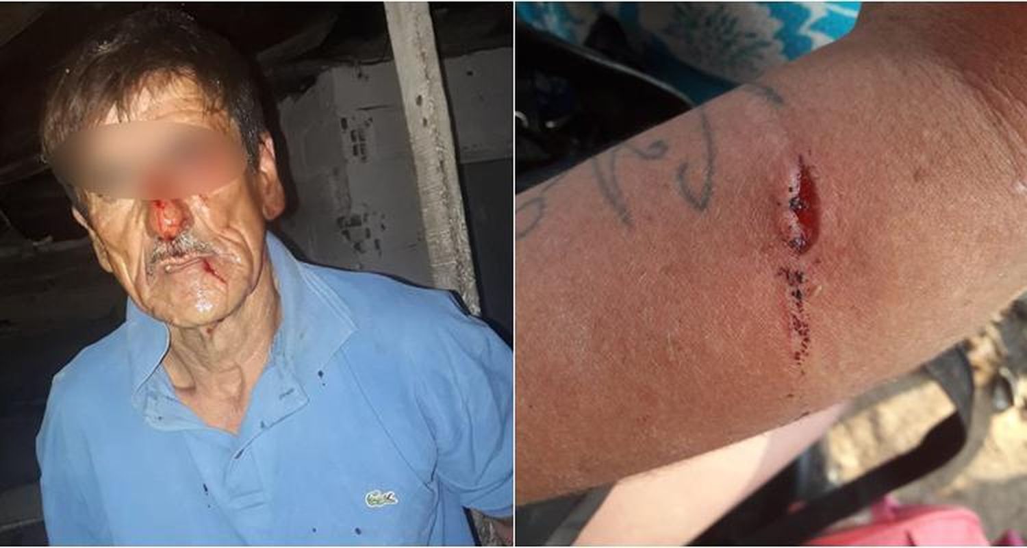 Usurparon cinco casas en Bajo Puerto: Una joven relató cómo golpearon salvajemente a su familia que tuvo que dejar el barrio