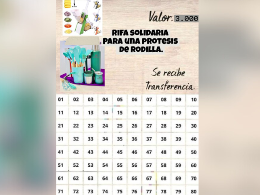 Rifa solidaria para Paula: necesita una prótesis de más de cinco millones para volver a caminar