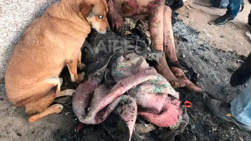 Quemaron a un hombre que duerme en la calle: Tiene 30% del cuerpo afectado