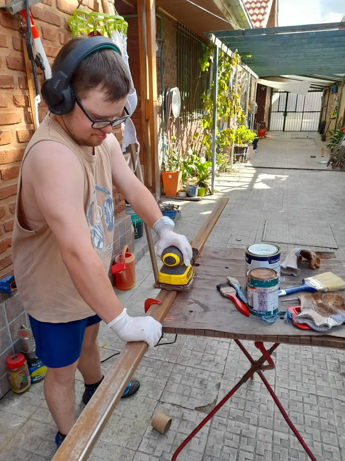 Sindrome de down - 4