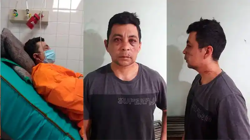 Enfermero recuperado de Covid-19 fue golpeado por vecinos e incendiaron su casa