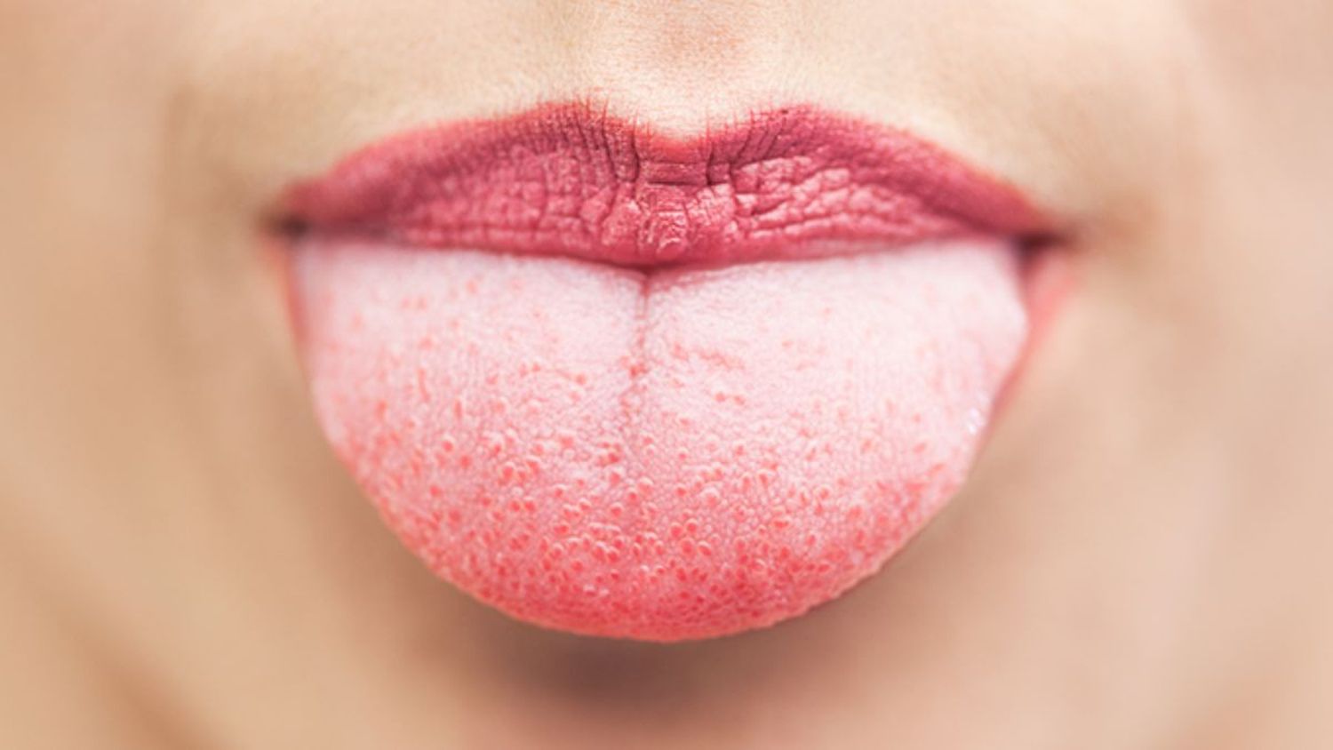 ¿Tienes la lengua blanca? Estas son las razones