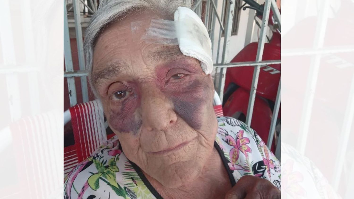 La mujer sufrió graves lesiones a raíz de los golpes.