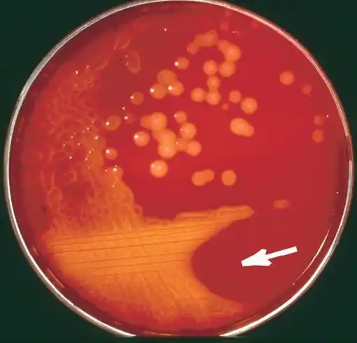 Streptococcus pyogenes, enemiga silenciosa