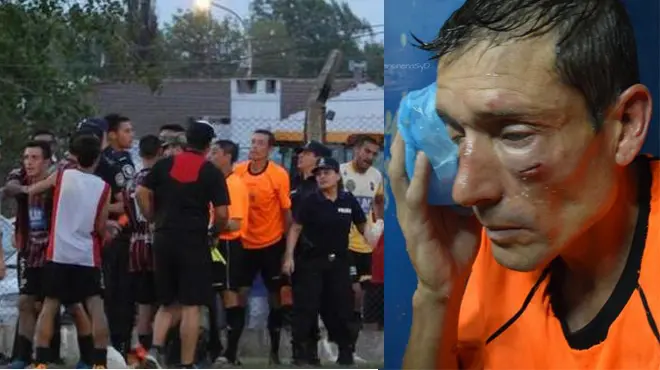 La insólita respuesta de Sarmiento de Ayacucho tras la agresión al árbitro