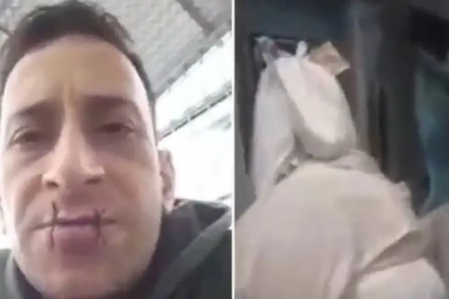 Denunció haber sido golpeado y violado en la cárcel: a modo de protesta se cosió la boca