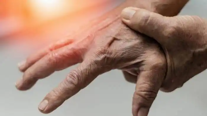 Descubren que la combinación  de dos medicamentos puede  revertir la artrosis