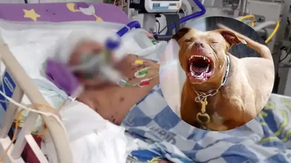 Niño fue atacado varias veces por dos perros callejeros en Ciudad Bolívar