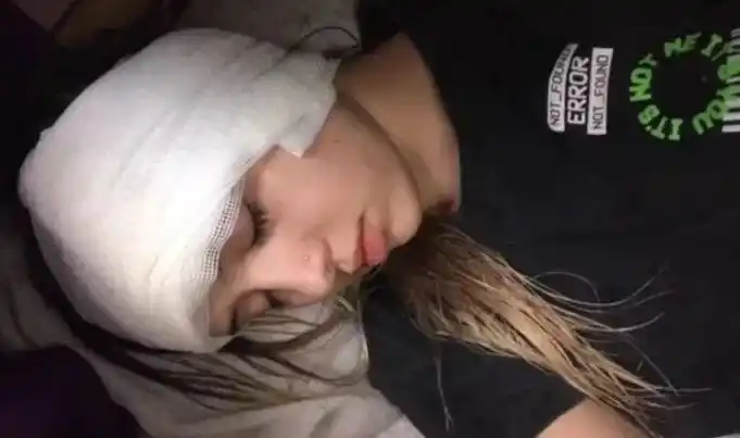 Brutal ataque a una moza: recibió 20 puntos, deberá ser operada y quedó sorda de un oído