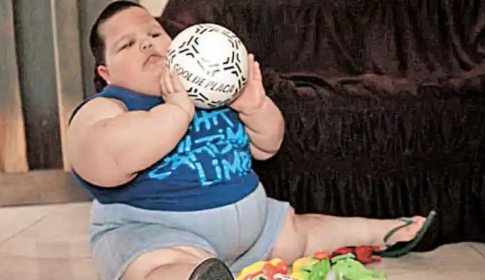 El drama de la obesidad infantil: Tiene 3 años y pesa 70 kilos
