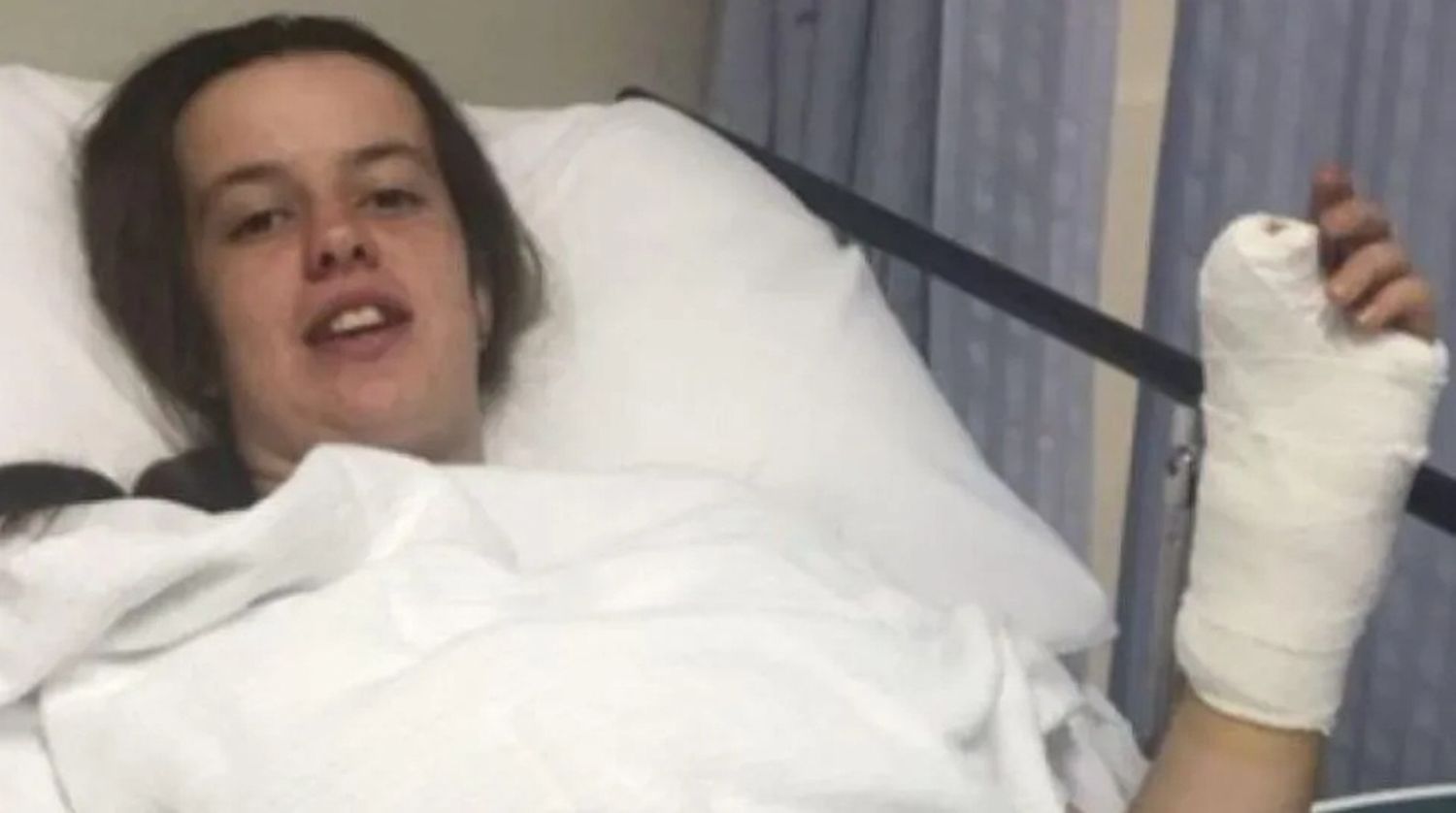 Por un error del médico le implantaron un dedo del pie en la mano