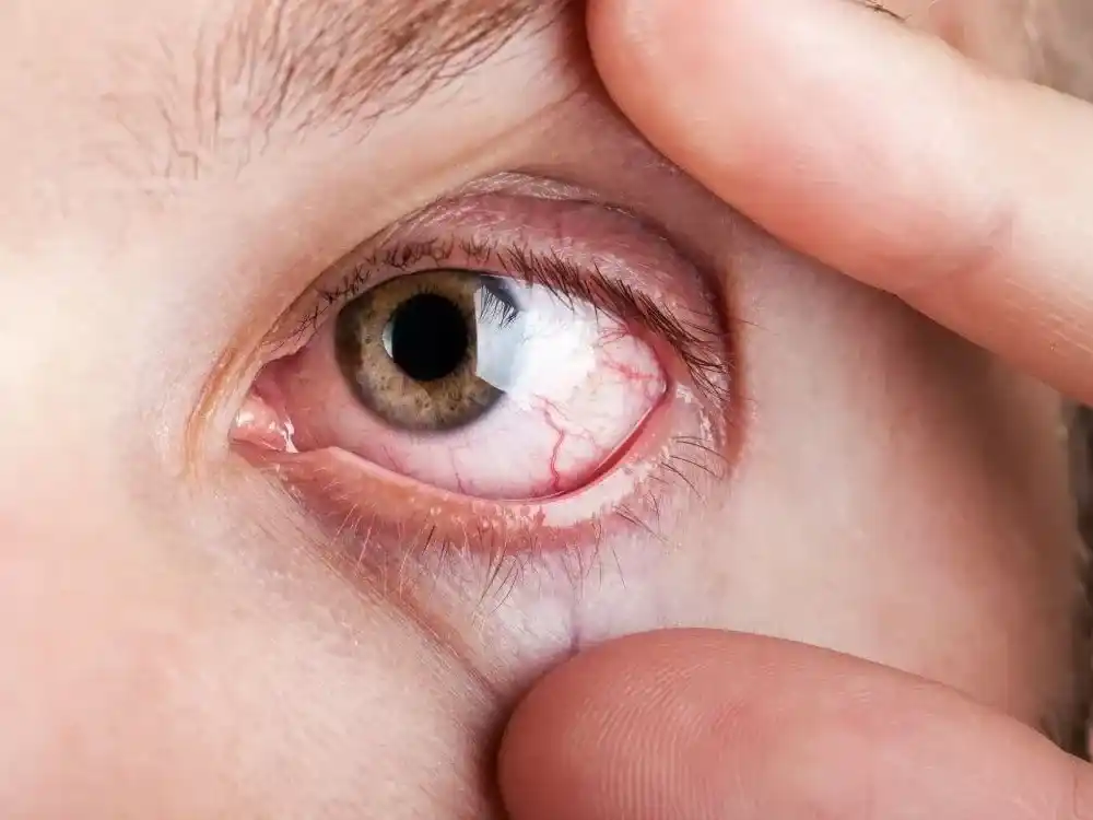 El nodavirus es ampliamente conocido en el sector productivo por causar elevadas tasas de mortalidad en criaderos, pero su presencia en humanos no se había registrado de manera formal hasta esta investigación.