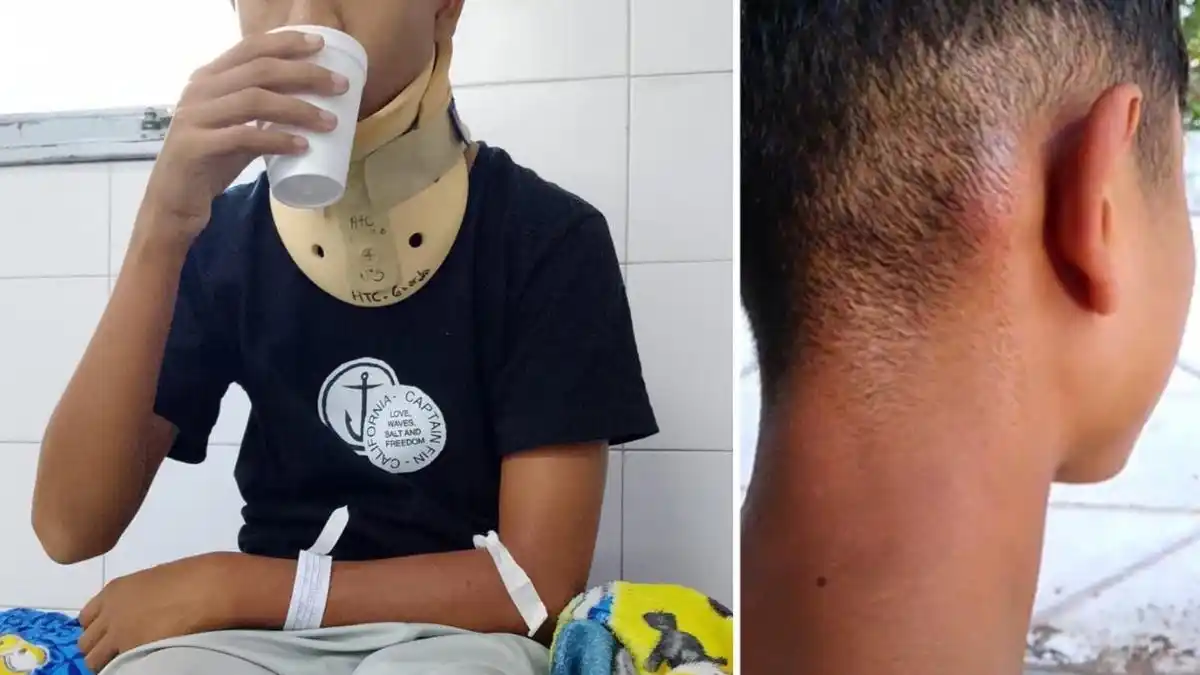 El adolescente tiene problemas de cervical tras el ataque