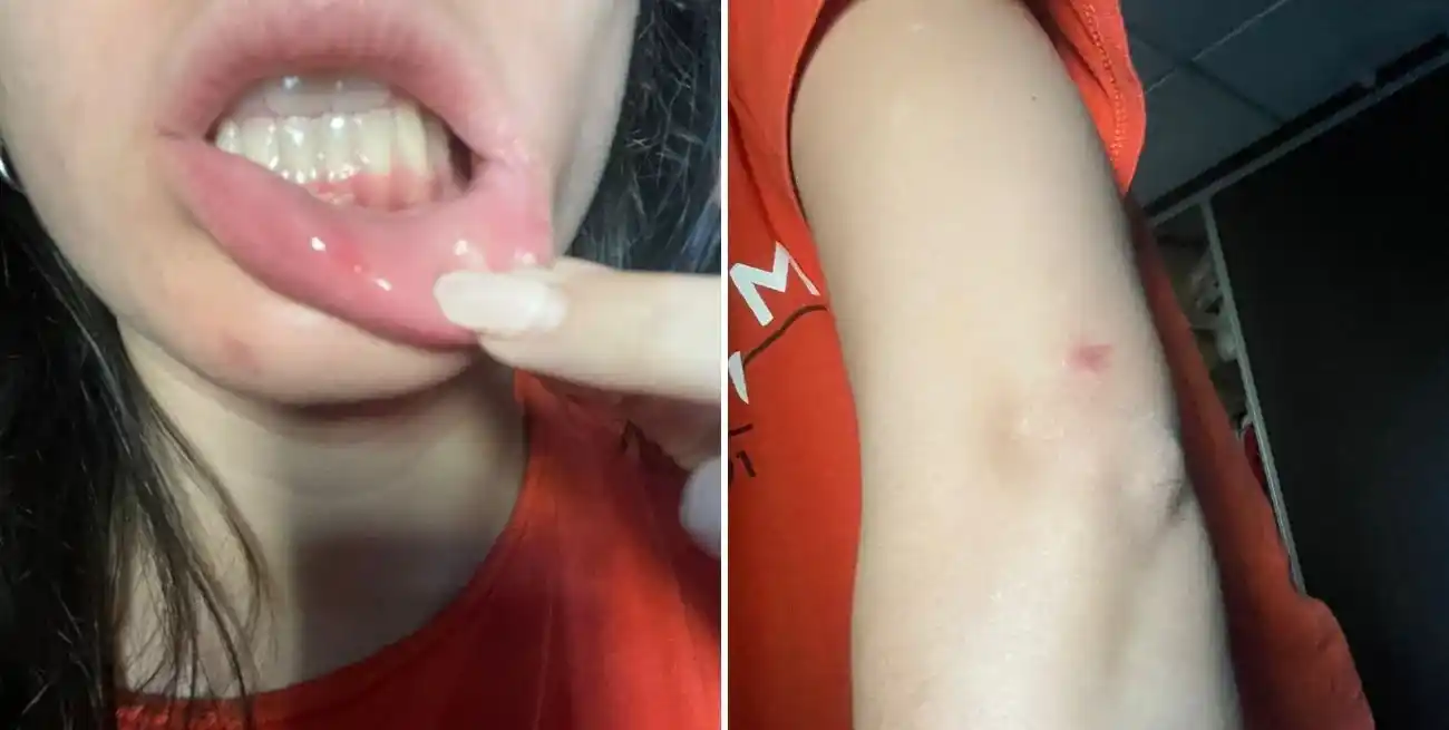 Valentina, la víctima. "Ahora dependo de otras personas para que me acompañen a ir y venir a mi trabajo".