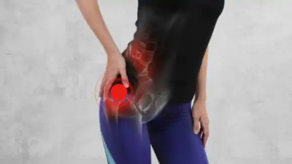 5 causas de la ciática