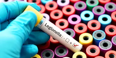 Brote de legionelosis en Nueva York: tres muertes y más de 80 infectados en Harlem