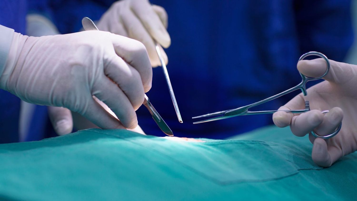 Acudió a una cirugía estética en un garaje y no salió con vida: LOS “MÉDICOS” HUYERON DE LUGAR